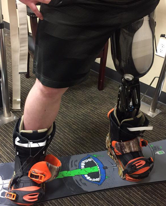 Man Mounting a Snowboard With a Prosthetic Limb